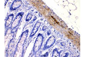 IHC analysis of CHRNA5 using anti-CHRNA5 antibody .