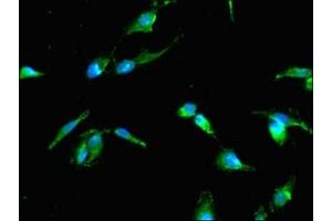 Immunofluorescent analysis of Hela cells using ABIN7173925 at dilution of 1:100 and Alexa Fluor 488-congugated AffiniPure Goat Anti-Rabbit IgG(H+L) (TP53I11 抗体  (AA 1-41))