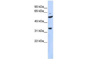Western Blotting (WB) image for anti-Zinc Finger Protein 36, C3H Type-Like 2 (ZFP36L2) (N-Term) antibody (ABIN2777902)