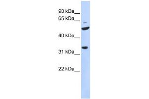 WB Suggested Anti-ZFP36L2 Antibody Titration:  0. (ZFP36L2 抗体  (N-Term))