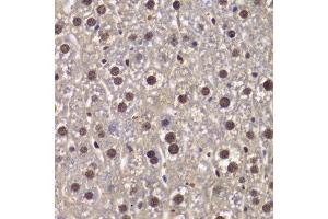 Immunohistochemistry of paraffin-embedded mouse liver using SMARCB1 antibody at dilution of 1:200 (400x lens). (SMARCB1 抗体)