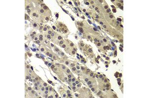 Immunohistochemistry of paraffin-embedded human stomach using SUB1 antibody (ABIN5974252) at dilution of 1/100 (40x lens). (SUB1 抗体)