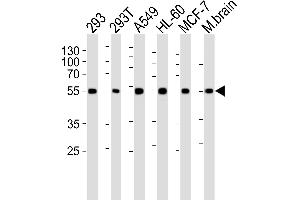 Western blot analysis of lysates from 293, 293T, A549, HL-60, MCF-7 cell line and mouse brain tissue lysate (from left to right), using DKK3 Antibody (A30) at 1:1000 at each lane. (DKK3 抗体  (N-Term))
