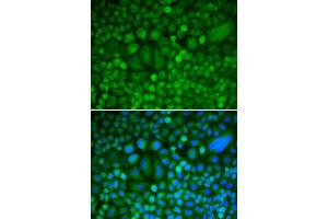 Immunofluorescence (IF) image for anti-Cyclin H (CCNH) (AA 1-323) antibody (ABIN3021259) (Cyclin H 抗体  (AA 1-323))