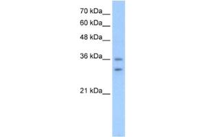 Western Blotting (WB) image for anti-Olfactory Receptor, Family 6, Subfamily C, Member 70 (OR6C70) antibody (ABIN2462825) (OR6C70 抗体)