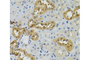 Immunohistochemistry of paraffin-embedded Rat kidney using NAT8 Polyclonal Antibody (NAT8 抗体)