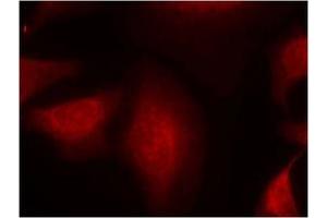 Image no. 1 for anti-Mdm2, p53 E3 Ubiquitin Protein Ligase Homolog (Mouse) (MDM2) (Ser166) antibody (ABIN319417) (MDM2 抗体  (Ser166))