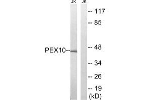 Western blot analysis of extracts from Jurkat cells, using PEX10 antibody. (PEX10 抗体  (Internal Region))