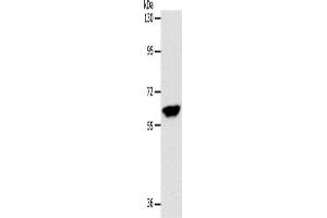 Western Blotting (WB) image for anti-Internexin Neuronal Intermediate Filament Protein, alpha (INA) antibody (ABIN2426549) (INA 抗体)