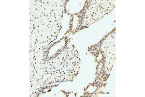 IHC analysis of AKAP 95/AKAP8 using anti-AKAP 95/AKAP8 antibody (ABIN7601553).