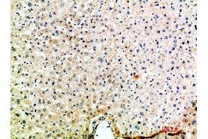 Immunohistochemical analysis of paraffin-embedded human-liver, antibody was diluted at 1:200 (CCL15 抗体  (AA 51-100))