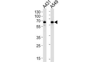 Western Blotting (WB) image for anti-Stress-Induced-phosphoprotein 1 (STIP1) antibody (ABIN3001649) (STIP1 抗体)