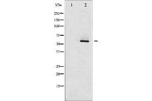 Western blot analysis of Estrogen Receptor- beta phosphorylation expression in HepG2 whole cell lysates,The lane on the left is treated with the antigen-specific peptide.
