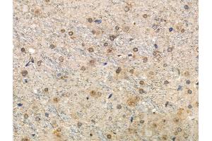 Phospho-Tau (Thr492/Thr175) Antibody at 1/100 staining Rat brain tissue by IHC-P.