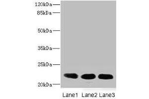 Western blot All lanes: CRIP2 antibody at 4. (CRIP2 抗体  (AA 1-208))