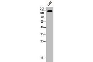 Western Blot analysis of 293T cells using Phospho-FAK (Y407) Polyclonal Antibody (FAK 抗体  (pTyr407))
