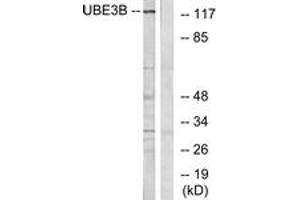 Western blot analysis of extracts from Jurkat cells, using UBE3B Antibody.