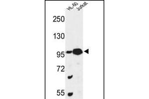 Western blot analysis of CS Antibody (N-term) (ABIN653334 and ABIN2842822) in HL-60, Jurkat cell line lysates (35 μg/lane). (CSPP1 抗体  (N-Term))