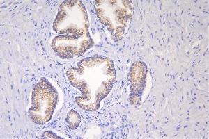 IHC analysis of DSG2 using anti-DSG2 antibody (ABIN7600803).