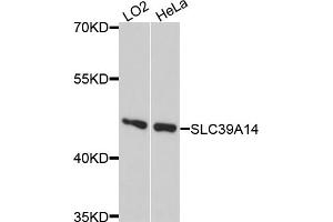 Western blot analysis of extracts of various cell lines, using SLC39A14 antibody. (SLC39A14 抗体)