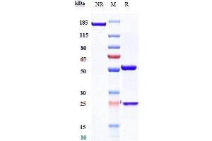 Anti-CXCR4 / CD184 Reference Antibody (ulocuplumab) on SDS-PAGE under reducing (R) condition. (Recombinant CXCR4 (Ulocuplumab Biosimilar) 抗体)