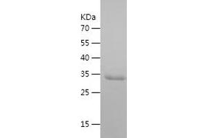 PRAME Protein (AA 321-420) (His-IF2DI Tag)