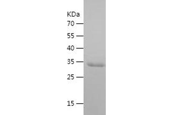 PRAME Protein (AA 321-420) (His-IF2DI Tag)