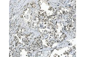 IHC analysis of TAF4 using anti-TAF4 antibody (ABIN7602114).