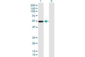 Western Blot analysis of IGHG1 expression in transfected 293T cell line by IGHG1 MaxPab polyclonal antibody. (IGHG1 抗体  (AA 1-469))
