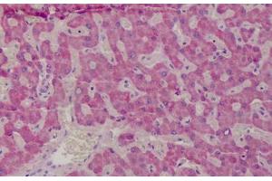 Human Liver: Formalin-Fixed, Paraffin-Embedded (FFPE) (GSTM1 抗体  (AA 1-159))