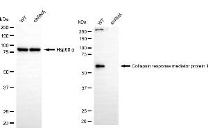 Western blotting analysis using collapsin response mediator protein 1 antibody (ABIN7798129). (Recombinant CRMP1 抗体)
