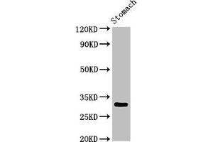 Western Blot Positive WB detected in: Rat stomach tissue All lanes: GCLM antibody at 3 μg/mL Secondary Goat polyclonal to rabbit IgG at 1/50000 dilution Predicted band size: 31, 29 kDa Observed band size: 31 kDa (GCLM 抗体  (Regulatory Subunit))