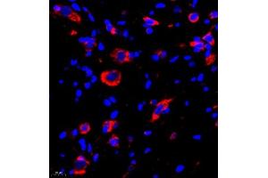 Immunofluorescence (Paraffin-embedded Sections) (IF (p)) image for anti-Neurotensin (NTS) antibody (ABIN7074827)