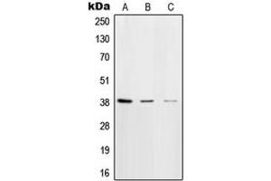 Western blot analysis of DNA Polymerase beta expression in HeLa (A), NIH3T3 (B), rat brain (C) whole cell lysates. (POLB 抗体  (C-Term))
