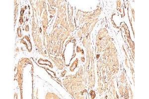 Immunohistochemistry (IHC) image for anti-Actin, alpha 2, Smooth Muscle, Aorta (ACTA2) (N-Term) antibody (ABIN3024126)