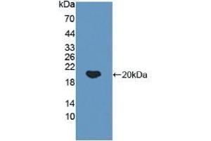 Detection of Recombinant IkBa, Human using Polyclonal Antibody to Inhibitory Subunit Of NF Kappa B Alpha (IkBa) (Inhibitory Subunit Of NF kappa B alpha (AA 74-247) 抗体)