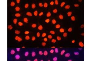 Immunofluorescence analysis of HeLa cells using TriMethyl-Histone H3-K64 Polyclonal Antibody at dilution of 1:100.