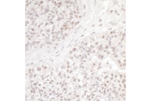 Immunohistochemistry (IHC) image for anti-NSL1, MIND Kinetochore Complex Component, Homolog (NSL1) (AA 150-200) antibody (ABIN7454374)