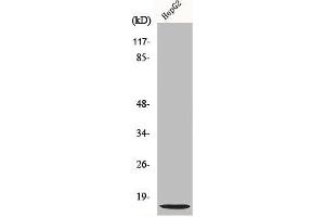 Western Blot analysis of Jurkat cells using NDUFA4L2 Polyclonal Antibody (NDUFA4L2 抗体  (C-Term))
