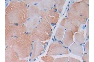 DAB staining on IHC-P; Samples: Mouse Skeletal muscle Tissue (MYLK2 抗体  (AA 330-548))