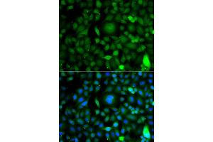 Immunofluorescence analysis of A549 cell using DPF1 antibody. (DPF1 抗体)