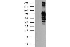 Western Blotting (WB) image for anti-Golgi Membrane Protein 1 (GOLM1) antibody (ABIN1498492) (GOLM1 抗体)