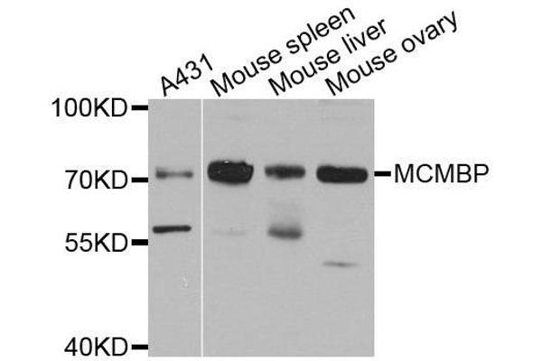 MCMBP antibody  (AA 1-240)