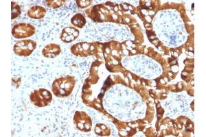 Formalin-fixed, paraffin-embedded human Small Intestine stained with SULT1E1 Mouse Monoclonal Antibody (CPTC-SULT1E1-1). (SULT1E1 抗体)