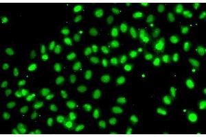 Immunofluorescence analysis of A549 cells using MEPCE Polyclonal Antibody (MEPCE 抗体)