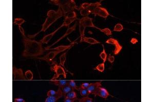 Immunofluorescence analysis of NIH/3T3 cells using ADAM11 Polyclonal Antibody at dilution of 1:100. (ADAM11 抗体)