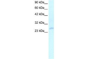 WB Suggested Anti-HOXC4 Antibody Titration:  2. (HOXC4 抗体  (N-Term))