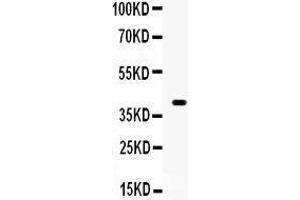 Western Blotting (WB) image for anti-Wingless-Type MMTV Integration Site Family, Member 1 (WNT1) (AA 45-74), (N-Term) antibody (ABIN3042350) (WNT1 抗体  (N-Term))