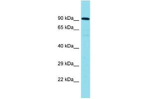 Host: Rabbit Target Name: CNOT10 Sample Type: Placenta lysates Antibody Dilution: 1. (CNOT10 抗体  (C-Term))