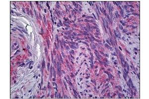 Human Uterus, Myometrium: Formalin-Fixed, Paraffin-Embedded (FFPE) (IFITM1 抗体)